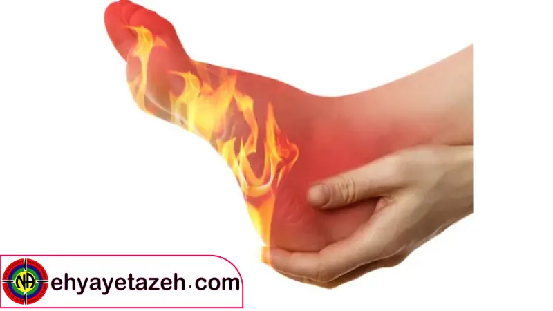 نقش سیستم عصبی در احساس سوزش کف پا پس از ترک اعتیاد