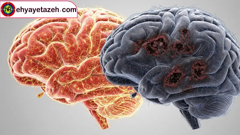 مکانیسم اثر شیشه بر مغز: چرا این اتفاق میافتد؟ 